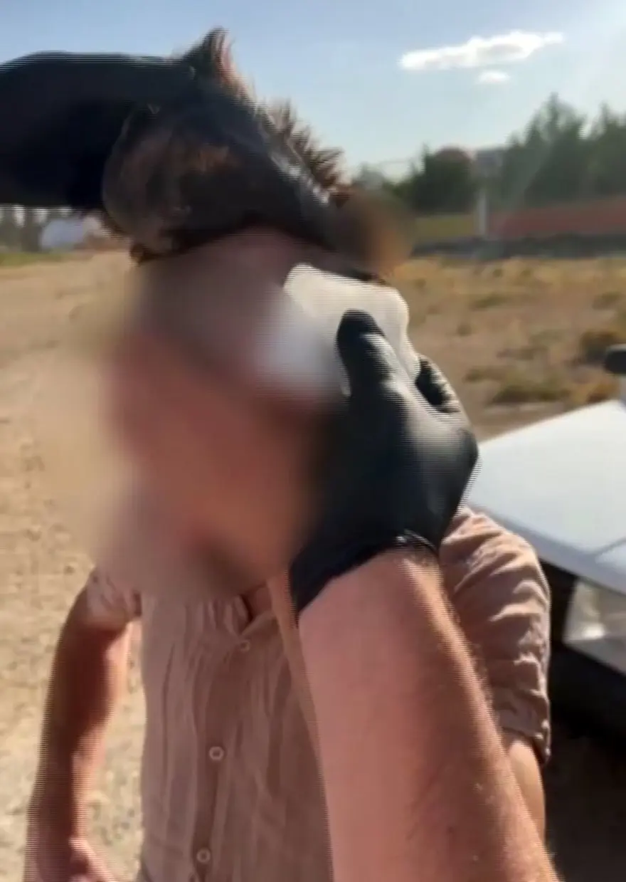 Polis şişlikten şüphelendi, peruğun altındanuyuşturucu çıktı 1