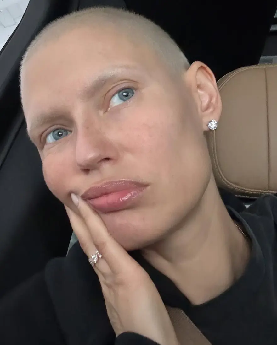 Ünlü model Bianca Balti kanserle savaşıyor: Victoria's Secret teklifimi reddetti 3 Ünlü model Bianca Balti kanserle savaşıyor: Victoria's Secret teklifimi reddetti 3