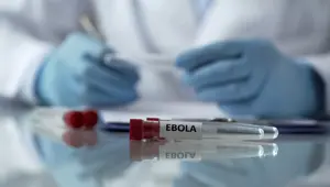 DSÖ'den Ebola uyarısı