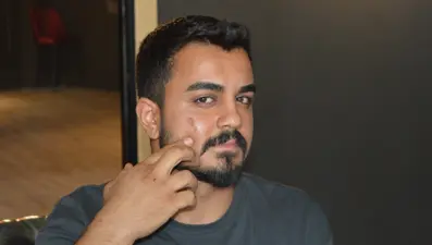 Lazer epilasyona gitti, yüzü yandı