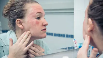 Sağlıksız bağırsakların 6 uyarı işareti Aynada yüzünüzü kontrol edin