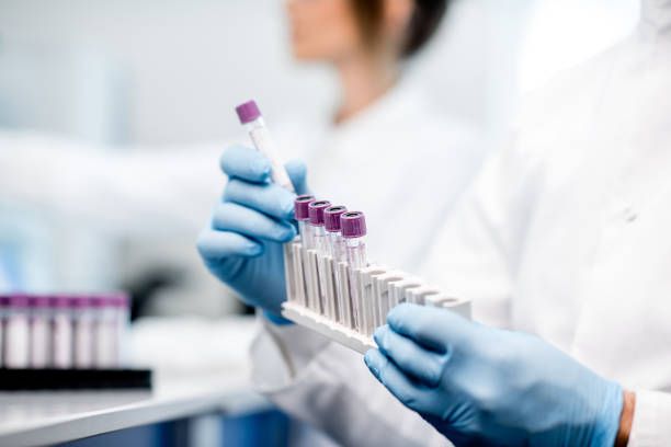 Bilirubin nedir? Bilirubin değeri kaç olmalıdır? Düşüklüğü ile yüksekliği nedenleri ve belirtileri