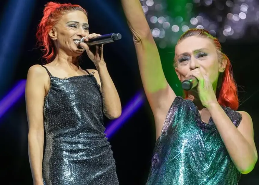 Yıldız Tilbe'den yeni paylaşım: Yüzünün hali endişelendirdi 