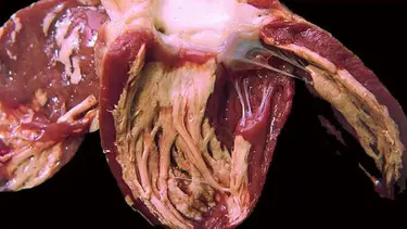 Deri hücresinden kalp kası oluşturuldu