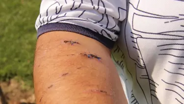 Otelde 'pitbull' dehşeti: Tatile gitti hastanelik oldu