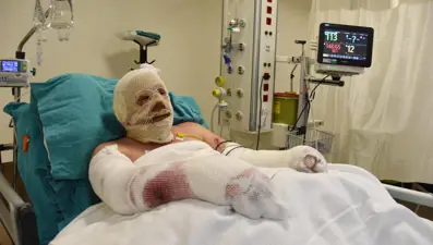 Denizli'deki orman yangınında alevlerin arasında kalan Yaşar Kozakbaş, yaşadıklarını anlattı