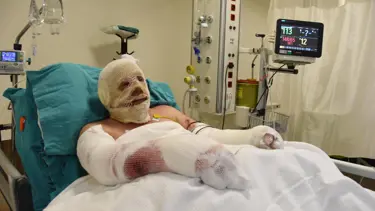 Denizli'deki orman yangınında alevlerin arasında kalan Yaşar Kozakbaş, yaşadıklarını anlattı