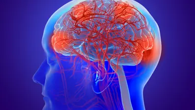 "Beyin pili ile parkinsonda kaybolan koku duyusunun geri getirildiği saptandı"