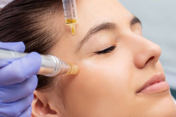 Fibroblast nedir? Fibroblast tedavisi nasıl yapılır?