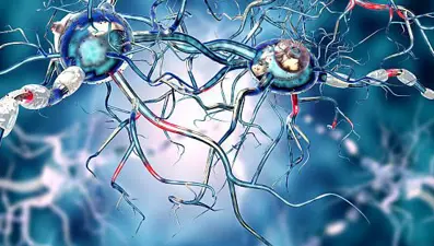 Huntington hastalığı nedir? Belirtileri nelerdir? Huntington hastalığı neden olur, tedavisi var mı?