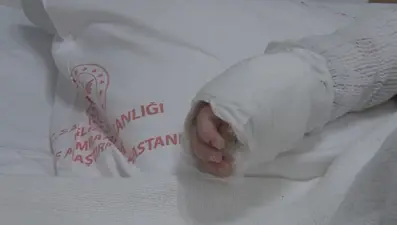 Üzerine kaynar su dökülen 20 aylık bebek taburcu edildi