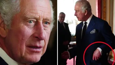 İngiltere'nin yeni kralının sosis parmakları endişe kaynağı oldu: 3. Charles hasta mı?