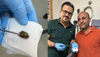 İşitme kaybıyla hastaneye gitti, kulağından çıkana inanamadı