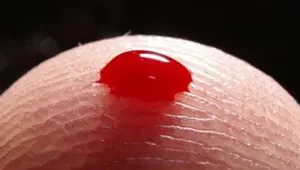 A’dan Z’ye lösemi gerçeği A’dan Z’ye lösemi gerçeği