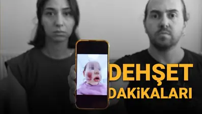 İki yaşındaki bebeğe kreşte dayak: "Yüzü parçalanmıştı, morluk içindeydi"