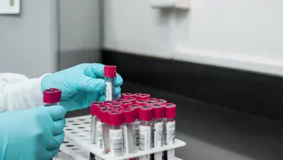 İngiltere’de bulaşıcı cinsel hastalıklar rekor seviyeye yükseldi