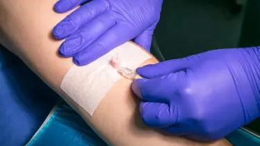 Kanserde her hastaya ayrı tedavi planı (Kanserde kişiye özel tedavi artacak)