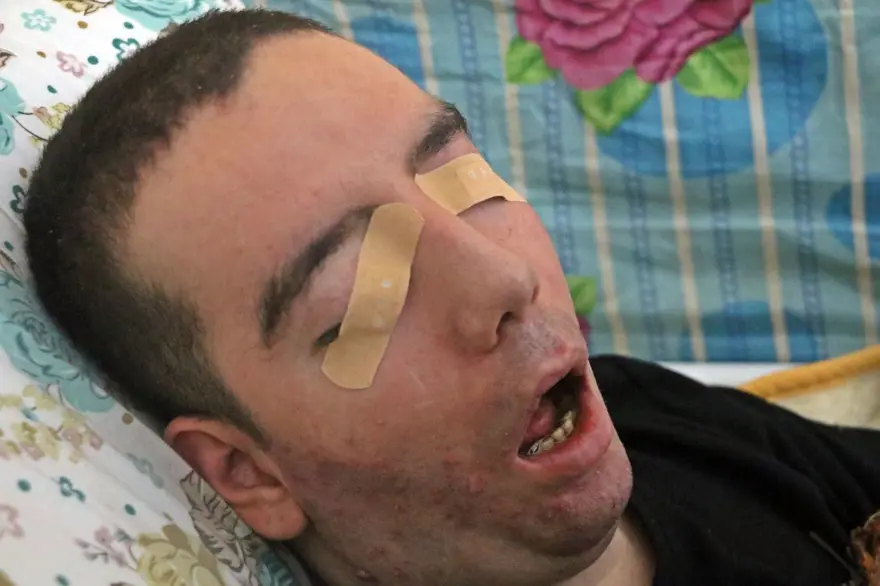 13 yıl gözlerini hiç kapatamadı, sesi kısık kaldı: SSPE hastası gencin acı hikayesi 2