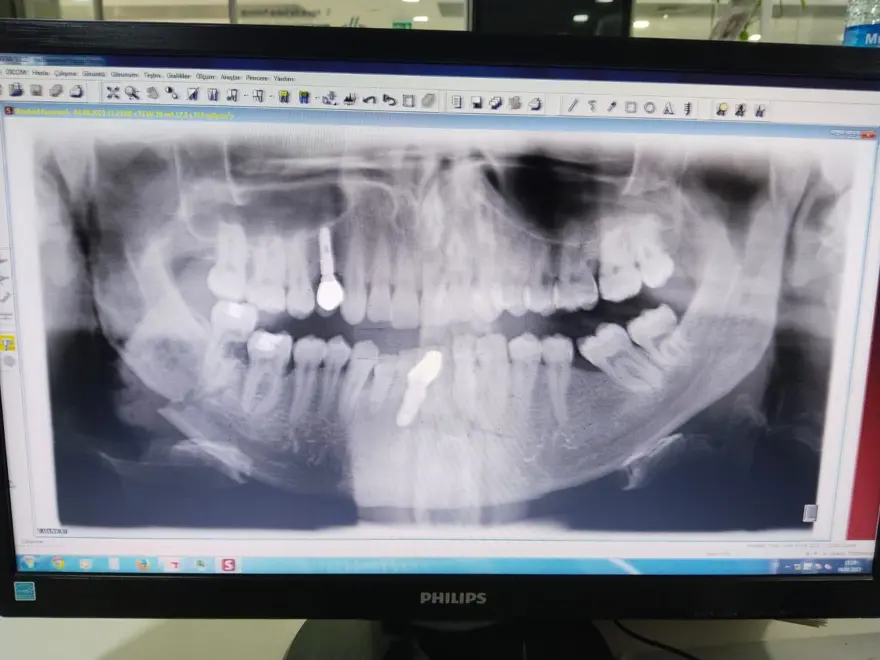 Veteriner hekime saldırı iddiası (Çenesinde ve vücudundakırıklar var) 3 Veteriner hekime saldırı iddiası (Çenesinde ve vücudundakırıklar var) 3