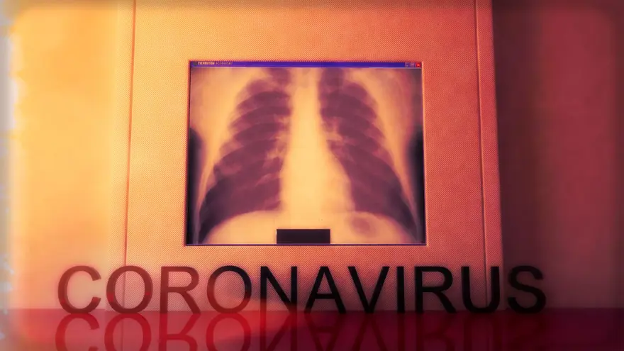 Hangi durumlarda COVID-19 enfeksiyonundan şüphelenilmeli? 6