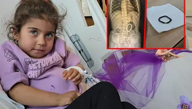 4 yaşındaki çocuğun bağırsağından çıkana doktorlar bile inanamadı: Oynadığı mıknatıslar bileklik olmuş