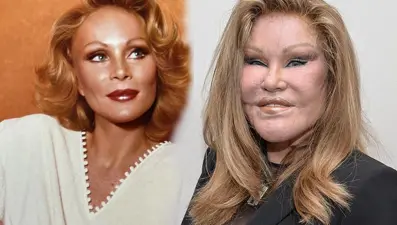 "Kedi Kadın" Jocelyn Wildenstein yaşamını yitirdi: Estetik bağımlılığıyla tanınıyordu