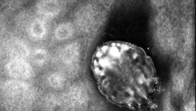 Karantina döneminde dirençli uyuz vakalarında artış