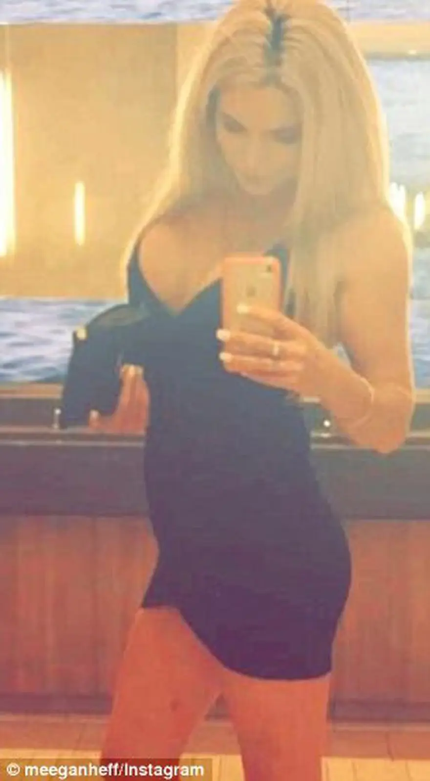 Ünlü vücut geliştirmeci protein kurbanı oldu! 4