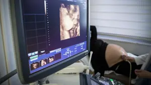 Yumurta dondurma yöntemi ile ileri yaşta anne olma şansı Yumurta dondurma yöntemi ile ileri yaşta anne olma şansı