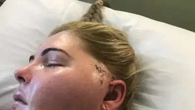 60 saniyelik baş ağrısı hayatını kararttı: Henüz 21 yaşındaydı