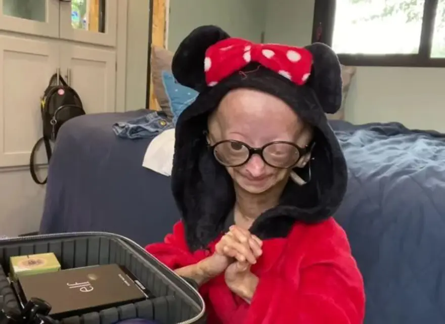 4 milyonda 1 görülüyor: Bu hastalığa yakalanan en fazla 20 yıl hayatta kalabiliyor 6 4 milyonda 1 görülüyor: Bu hastalığa yakalanan en fazla 20 yıl hayatta kalabiliyor 6