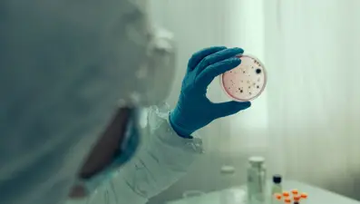 Nijerya'da kolera nedeniyle 35 kişi öldü