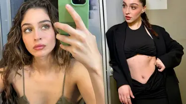 Cemre Baysel'den estetik açıklaması: Yaptırırsam gizlemem