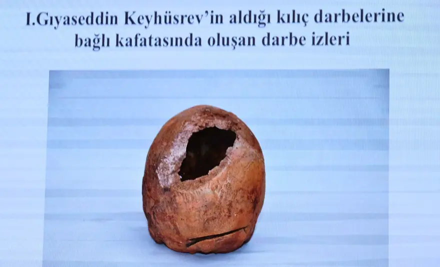 Selçuklu sultanlarının DNA analizi yapıldı: Hastalıkları ve ölüm nedenleri belirlendi 13