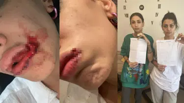İstanbul'da kız kardeşlere sokak ortasında saldırı