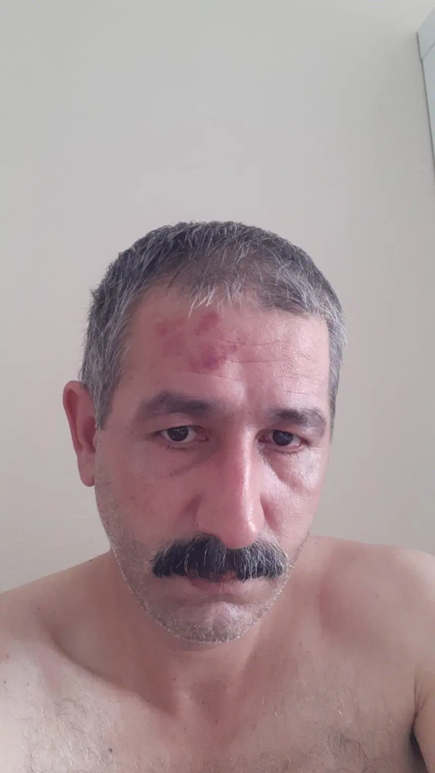 "Niye çöp atıyorsun?" deyince15 kişi saldırdı 4