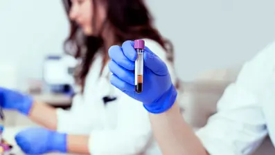 Damar tıkanıklığı (tromboz) her 4 kişiden birini hayattan koparıyor