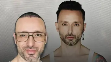 "Saç estetiği yaptırdım" demişti... İşte Mabel Matiz son imajı