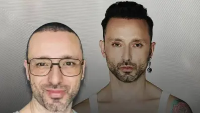 "Saç estetiği yaptırdım" demişti... İşte Mabel Matiz son imajı