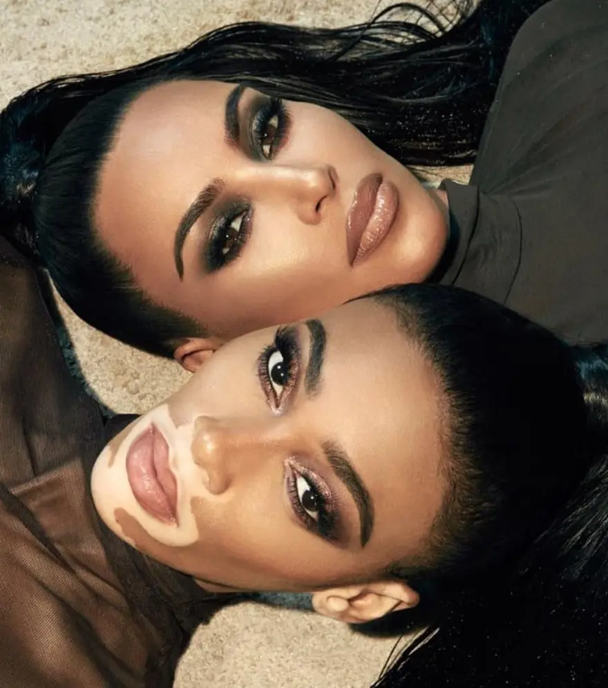 Kim Kardashian ile Winnie Harlow’dan reklam işbirliği 