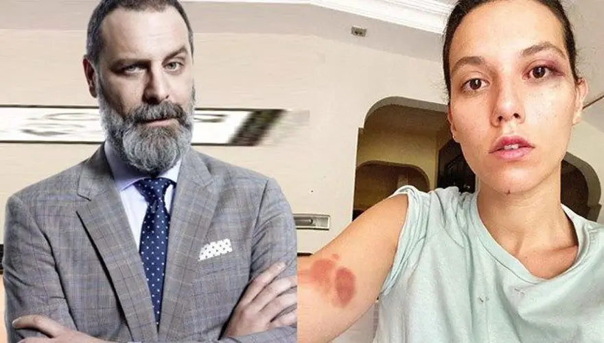 Ozan Güven ve Deniz Bulutsuz'un karşılıklı yargılandıkları dava: Ayağının altında cam kesikleri vardı Ozan Güven ve Deniz Bulutsuz'un karşılıklı yargılandıkları dava: Ayağının altında cam kesikleri vardı