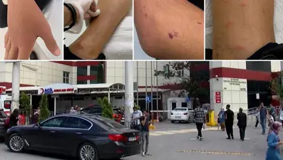 İstanbul'da sivrisinekler hastanelik etmeye başladı