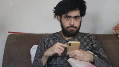 3 yıldır evden dışarı adım atmadı: "Banyo da yapmak istemiyorum, elimde olsa tuvalete gitmem"