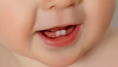 Bebeklerde diş çıkarma belirtileri nelerdir? Bebeklerde diş çıkarma ne zaman başlar? Nasıl anlaşılır?