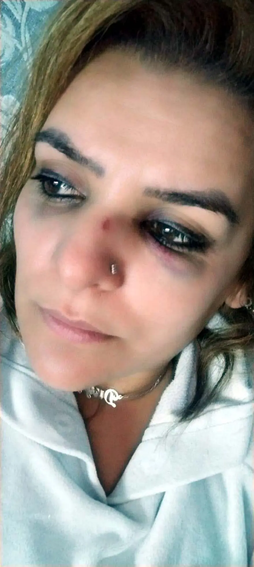 Roman ailelerin fahri koordinatörüne saldırı 