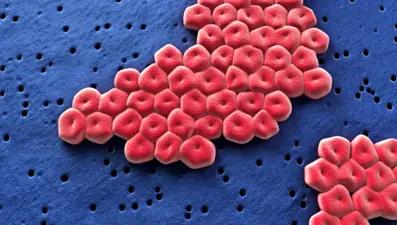 Antibiyotik dirençli "süper bakteri" tespit edildi: Bilim insanlarından "ölümcül" uyarı