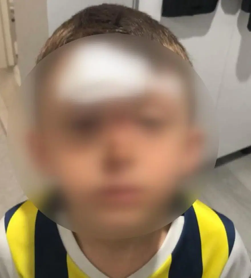 Kreşte korku dolu anlar: 5 yaşındaki çocuk inşaat alanına düştü 1