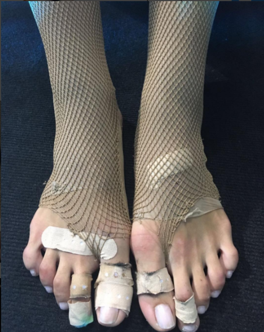 Hande Erçel’in ayakları alay konusu oldu 3 Hande Erçel’in ayakları alay konusu oldu 3