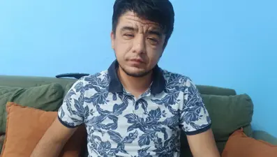 20 yaşındaki Enes’in nadir hastalığı (Pachydermoperiostosistanısı konuldu)