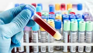 PCR testi ücretli mi, PCR testi yaptırmak için randevu gerekli mi? (PCR testi nedir, nasıl yapılır?)